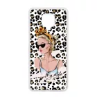 My Style Girl Leopard Wild Beauty Animal Fashion Csajos Allat mintas Xiaomi tok