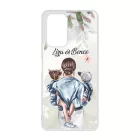 Kerd a neveddel Anya es a Gyerekek Xiaomi tok